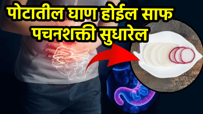 पोट होईल झटक्यात साफ! फक्त ही पांढरी गोष्ट खा, पचनशक्ती सुधारेल तर गॅस, अ‍ॅसिडिटी होईल दूर