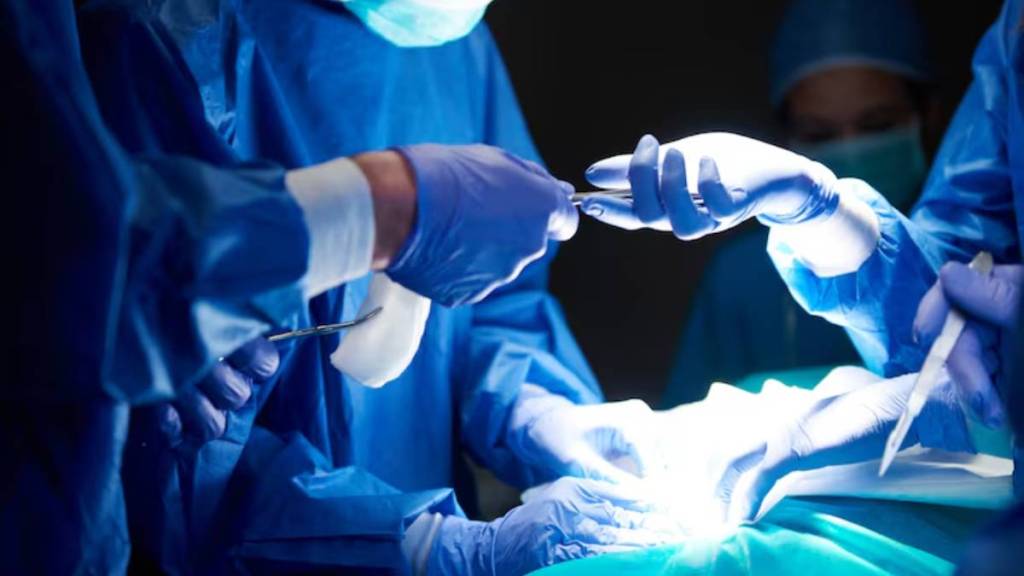 doctors successfully remove stones