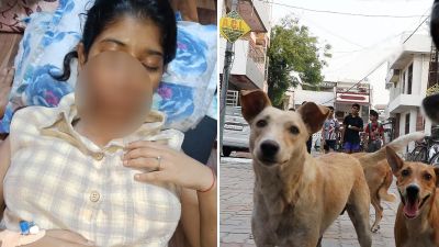 कुठे गेले प्राणीमित्र? भटक्या कुत्र्यांनी तरुणीच्या गालाचा लचका तोडला, १७ टाके पडले