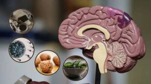 स्मरणशक्ती होईल तीक्ष्ण, अल्झायमरचं नो टेन्शन; मेंदूचं आरोग्य ठणठणीत ठेवणाऱ्या १० पदार्थांचा आहारात करा समावेश