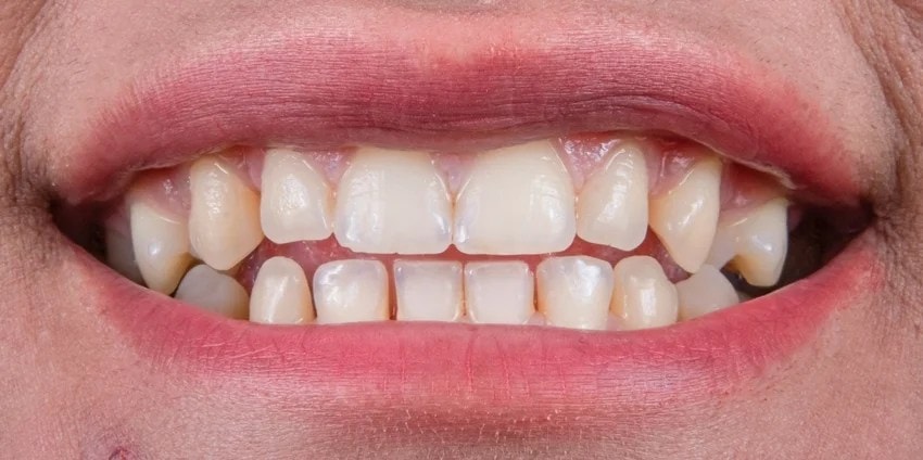 teeth shape personality what your teeth reveal about your luck and life