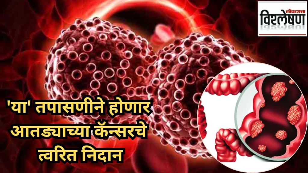 AI detect colorectal cancer