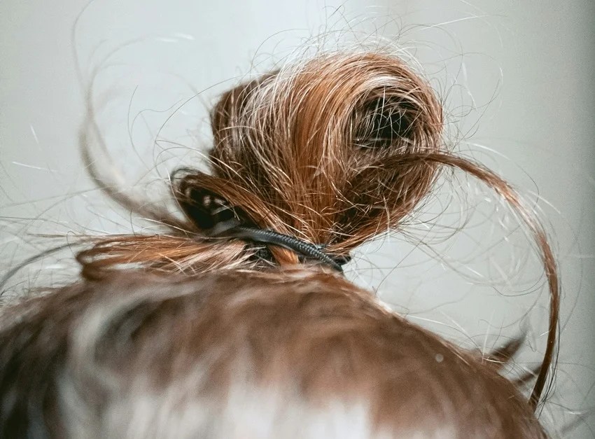 how amla can harm your hair