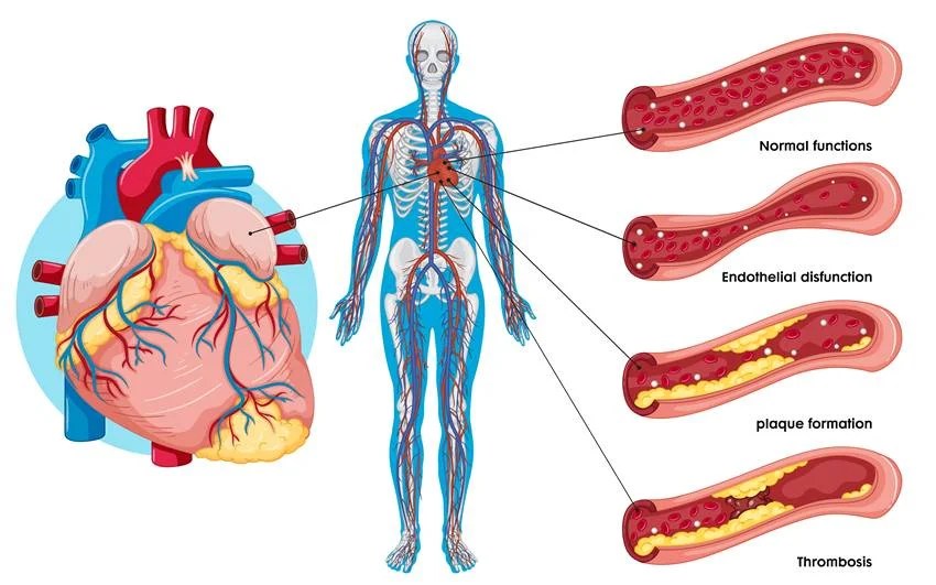 five ayurvedic remedies to improve blood circulation increase strength and keep the heart healthy