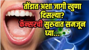 Oral cancer prevention tips