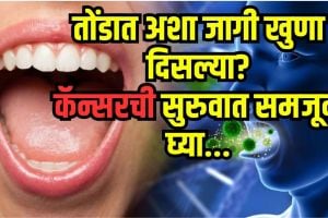 Oral cancer prevention tips