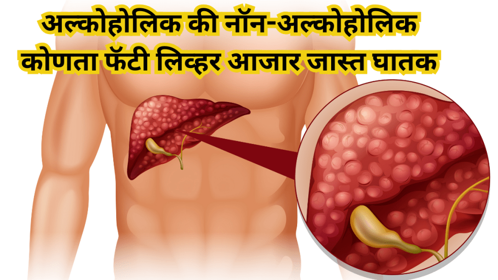 Fatty Liver Disease Alcoholic vs Non-Alcoholic
