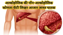Alcoholic की Non-Alcoholic : कोणता फॅटी लिव्हर शरीरासाठी जास्त घातक? जाणून घ्या लक्षणे व बचावाचे उपाय