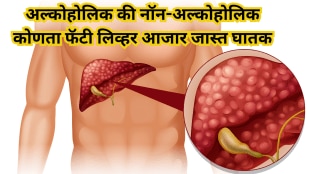 Fatty Liver Disease Alcoholic vs Non-Alcoholic