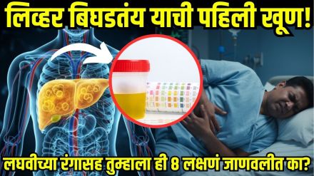 Causes of Fatty Liver Disease Causes of Fatty Liver Disease