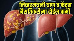 २८ दिवसांत लिव्हरवर जमलेला फॅट्सचा किळसवाणा थर होईल कमी; डाॅक्टरांनी सांगितलेले ‘हे’ ७ उपाय करा, लिव्हरमधील घाण होईल साफ