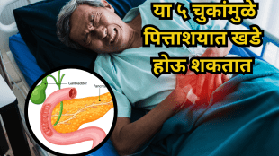 Gallstones