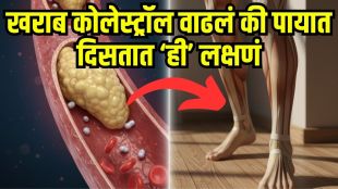 Early warning signs of cholesterol