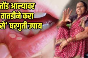 Home Remedies for Mouth Ulcers