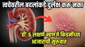किडनी खराब व्हायला सुरूवात झाल्यास त्वचेवर दिसतात ‘ही’ ६ धोक्याची चिन्हे; आरशात दिसणारे बदल वेळीच ओळखा, नाहीतर…