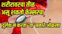 शरीरावर असणारा तीळ कॅन्सरचा आहे की नाही?; दुर्लक्ष न करता ‘या’ प्रकारे ओळखा अन्यथा ब्रेस्ट कॅन्सरचा धोका