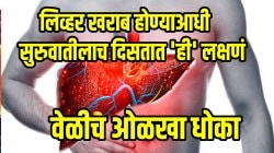 फॅटी लिव्हरचा धोका अचानक वाढतो; लिव्हर खराब होण्याआधी सुरुवातीलाच दिसतात ‘ही’ लक्षणं, वेळीच ओळखा धोका
