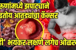 Colon cancer and cruciferous vegetables: 7 vegetables that may cut colon cancer risk by up to 20% Colon Cancer symptoms