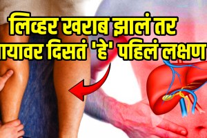 Liver weakness sign and symptoms start eating these 5 food to cure liver beetroot walnut green leafy vegetables garlic and turmeric for liver health