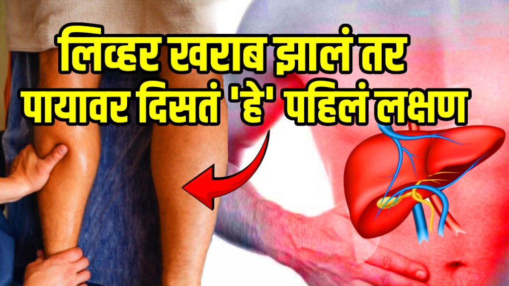 Liver weakness sign and symptoms start eating these 5 food to cure liver beetroot walnut green leafy vegetables garlic and turmeric for liver health