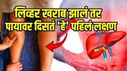 पायावर दिसणारं ‘या’ एकाच लक्षणानं कळेल लिव्हर खराब होतंय का? अजिबात दुर्लक्ष करू नका नाहीतर…; डॉक्टरांनी सांगितला उपाय