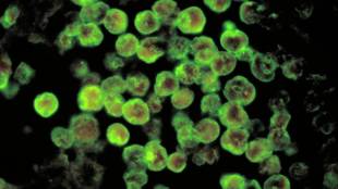 Brain-Eating Amoeba