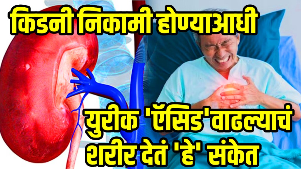 know the 5 natural ways to get down uric acid and relief joint pain