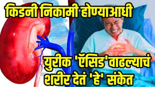 know the 5 natural ways to get down uric acid and relief joint pain
