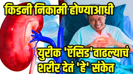 know the 5 natural ways to get down uric acid and relief joint pain