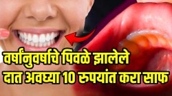 अवघ्या १० रुपयांचे ‘हे’ दोन पदार्थ काढतील दातांवरील पिवळा थर; १०० वर्षे मजबूत राहतील दात, तोंडाची दुर्गंधीही निघून जाईल