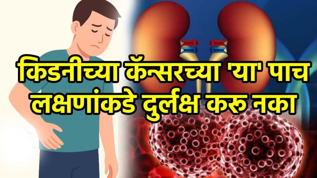 kidney cancer symptoms