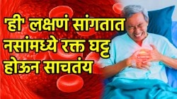 ‘ही’ लक्षणं असतील तर नसांमध्ये रक्त घट्ट होऊन साचतंय; हार्ट अटॅकपासून बचाव करायचा आहे तर अजिबात दुर्लक्ष करु नका