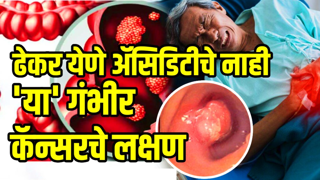 Colon cancer warning signs frequent burping led to diagnosis of cancer in 24 year old woman