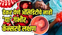वारंवार ढेकर येणे अ‍ॅसिडिटीचे नाही ‘या’ गंभीर कॅन्सरचे लक्षण; शरीरात ‘हे’ बदल दिसताच लगेच सावध व्हा