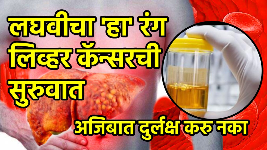 liver cancer symptom
