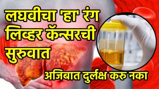 liver cancer symptom