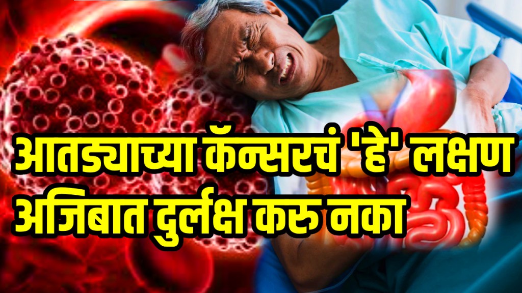 Colon cancer symptoms harvard gastroenterologist shares 8 sign and symptoms of colon cancer