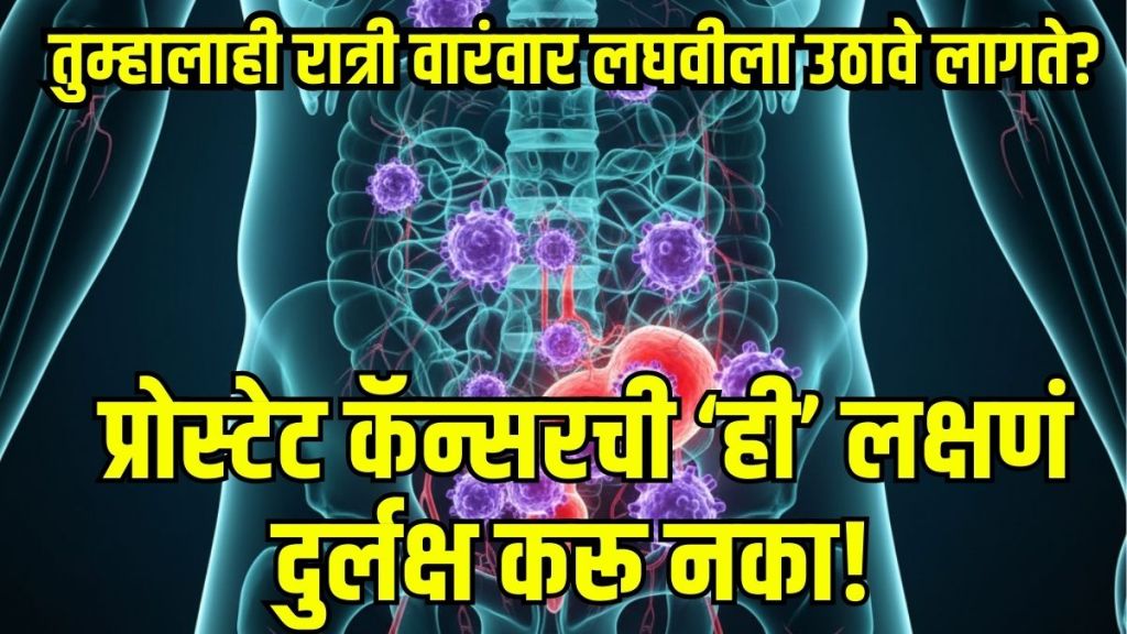 Urologist advice prostate cancer