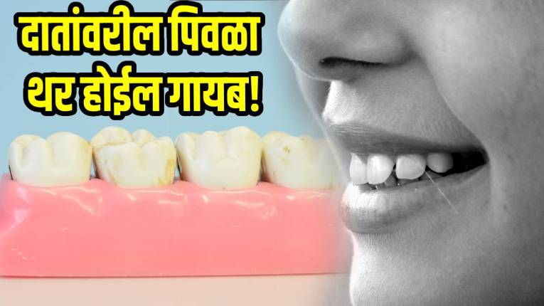 ‘या’ ३ गोष्टी दातांवरील पिवळा थर करतील मिनिटांत दूर; फायदे काय, कसा करायचा वापर; जाणून घ्या तज्ज्ञांकडून