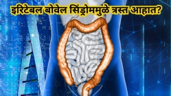 इरिटेबल बोवेल सिंड्रोममुळे त्रस्त आहात? हे ४ सप्लिमेंट्स ठरतात रामबाण, काही दिवसांतच मिळेल आराम