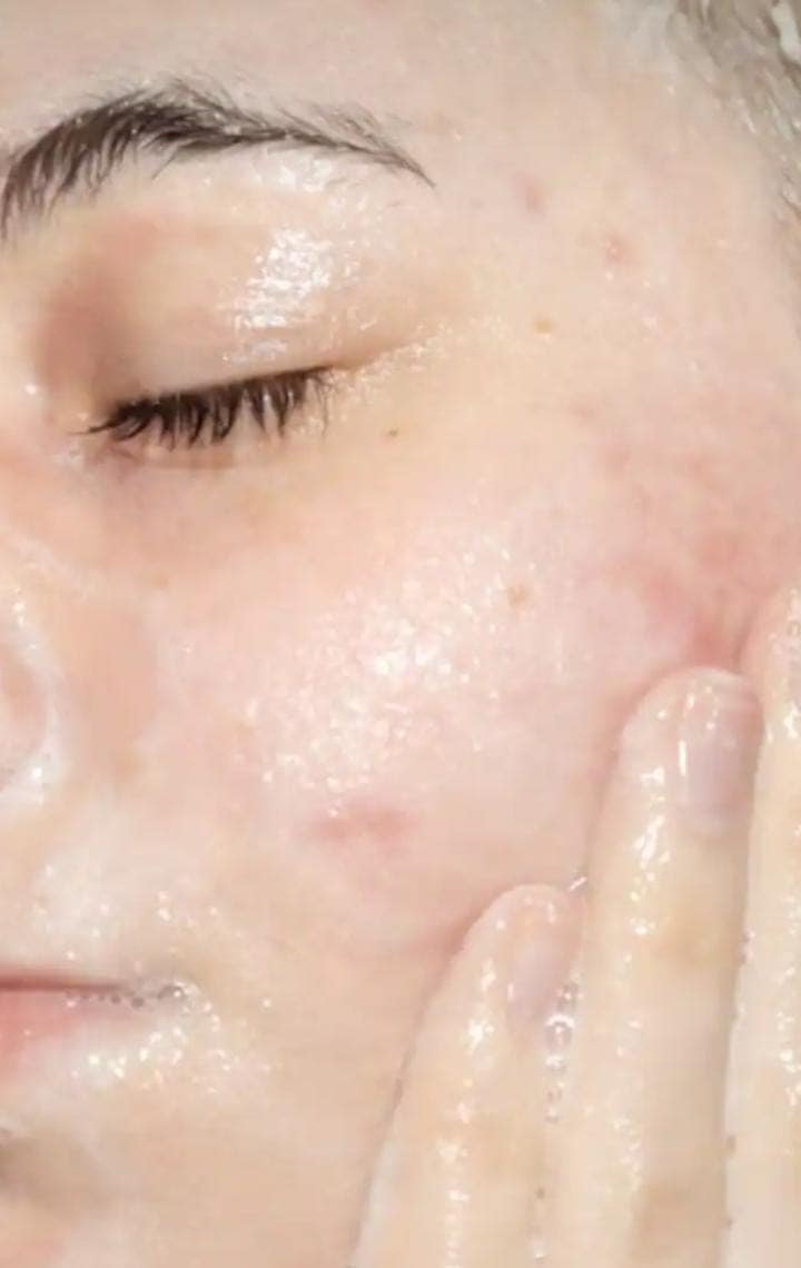 Aloe Vera Gel :