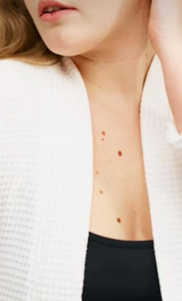 women cancer early warning signs and symptoms