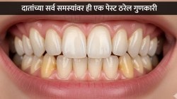 दातांच्या दुखण्यावर करा ‘हा’ रामबाण उपाय… पिवळेपणा, दातदुखी सगळ्यावर ‘ही’ एक पेस्ट ठरेल गुणकारी