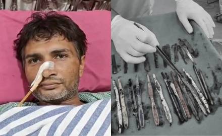 २९ चमचे, १९ टूथब्रश आणि २ पेन गिळले? हा जिवंत कसा राहिला?
