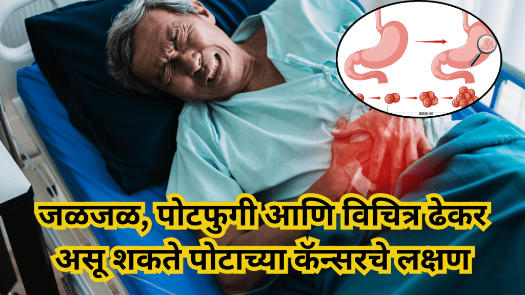 acidity, bloating, burping, stomach cancer, stomach cancer symptoms