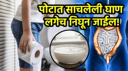 पोटात साचलेली घाण लगेच निघून जाईल! दह्यासोबत खा फक्त ‘ही’ गोष्ट, गॅस होईल कमी आणि पचनही सुधारेल