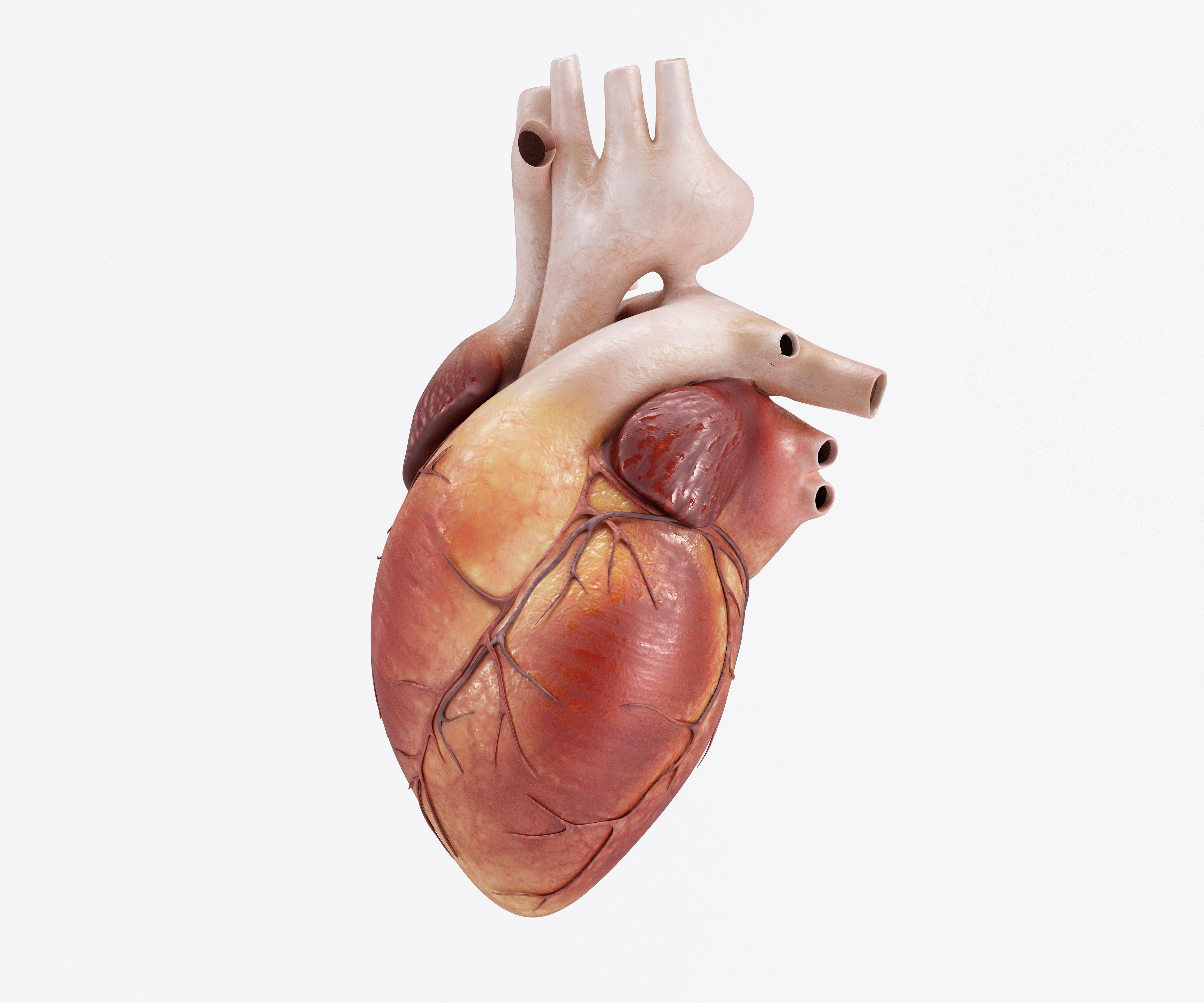 Heart cancer