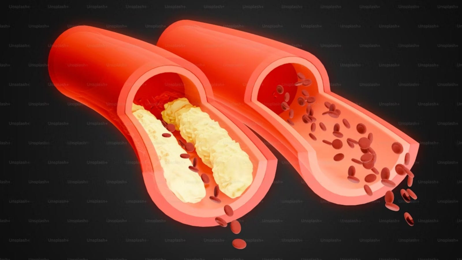 heart health