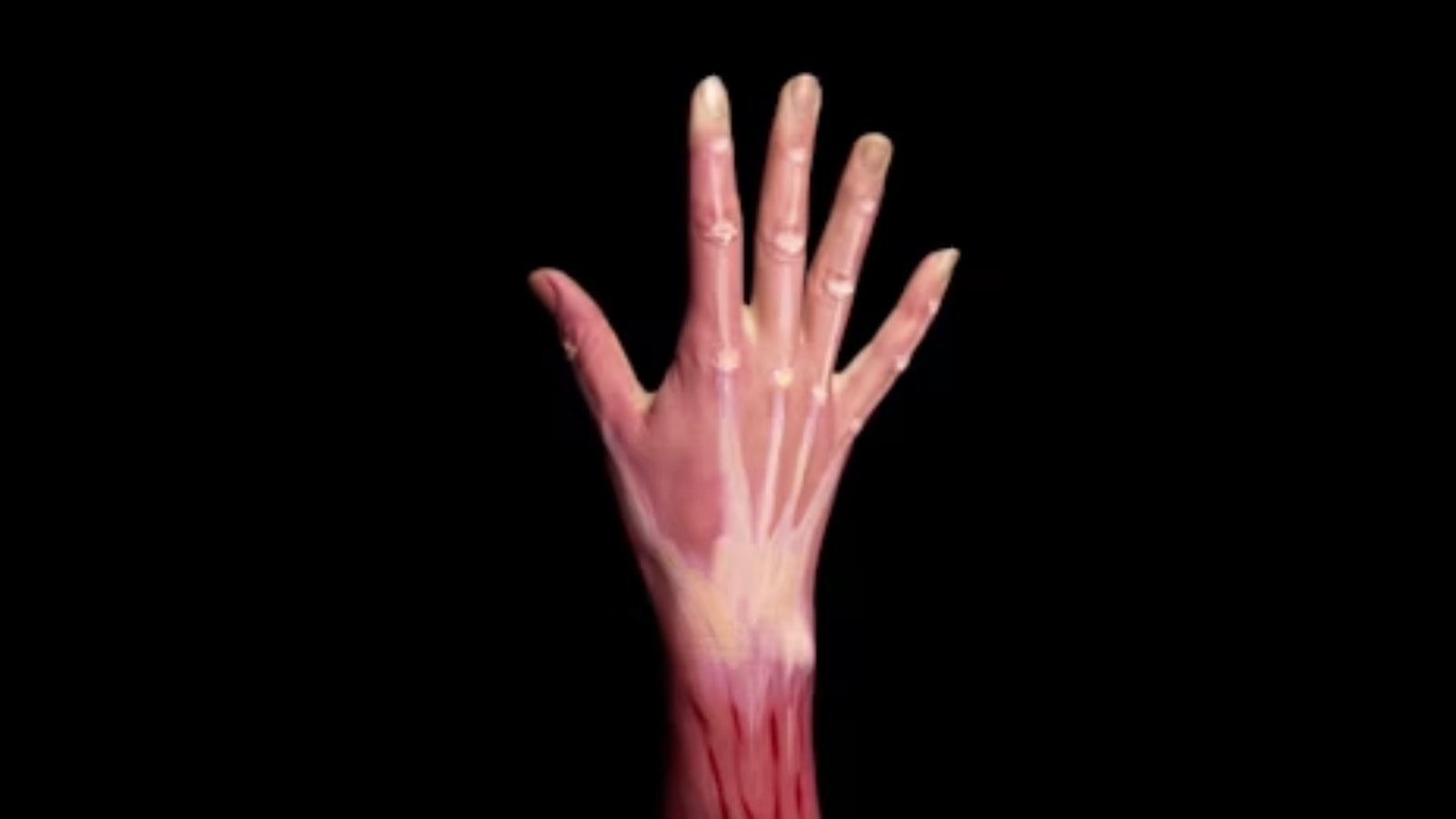 poor circulation, health
