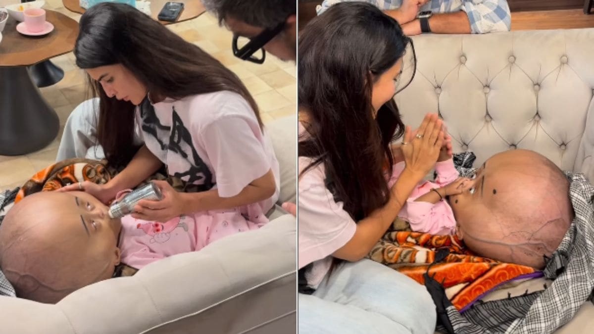 jacqueline fernandez meets child with rare condition she steps in to help child with hydrocephalus